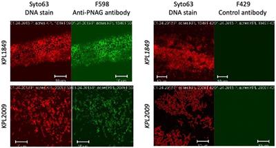 Poly-β-(1→6)-N-acetyl-D-glucosamine mediates surface attachment, biofilm formation, and biocide resistance in Cutibacterium acnes